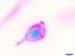 Pink&Blue